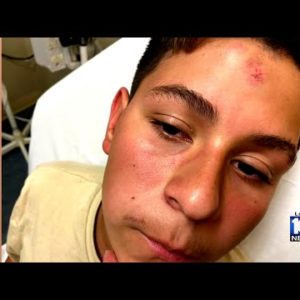 Police investigating teen's brutal beatdown at West Broward High School