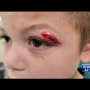Mother seeks answers on how school handled son's injuries after he was hit during recess