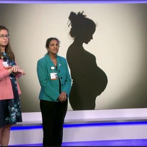 How epilepsy impacts pregnancy