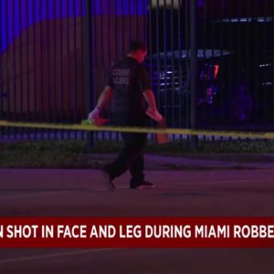 Man shot in face during robbery in Miami