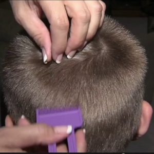 What to do if your child gets lice