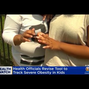 CDC Revises Tools To Measure Severe Child Obesity
